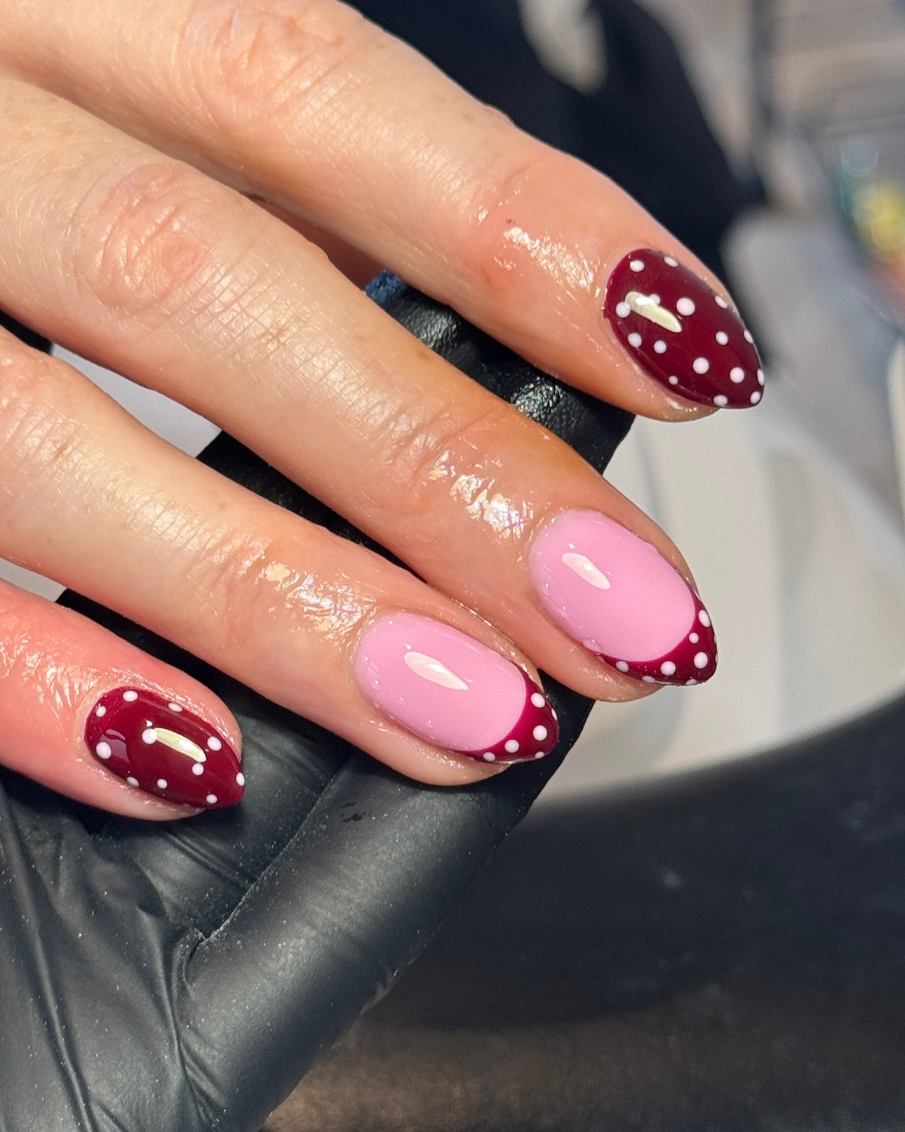 Winny urok na końcówkach palców